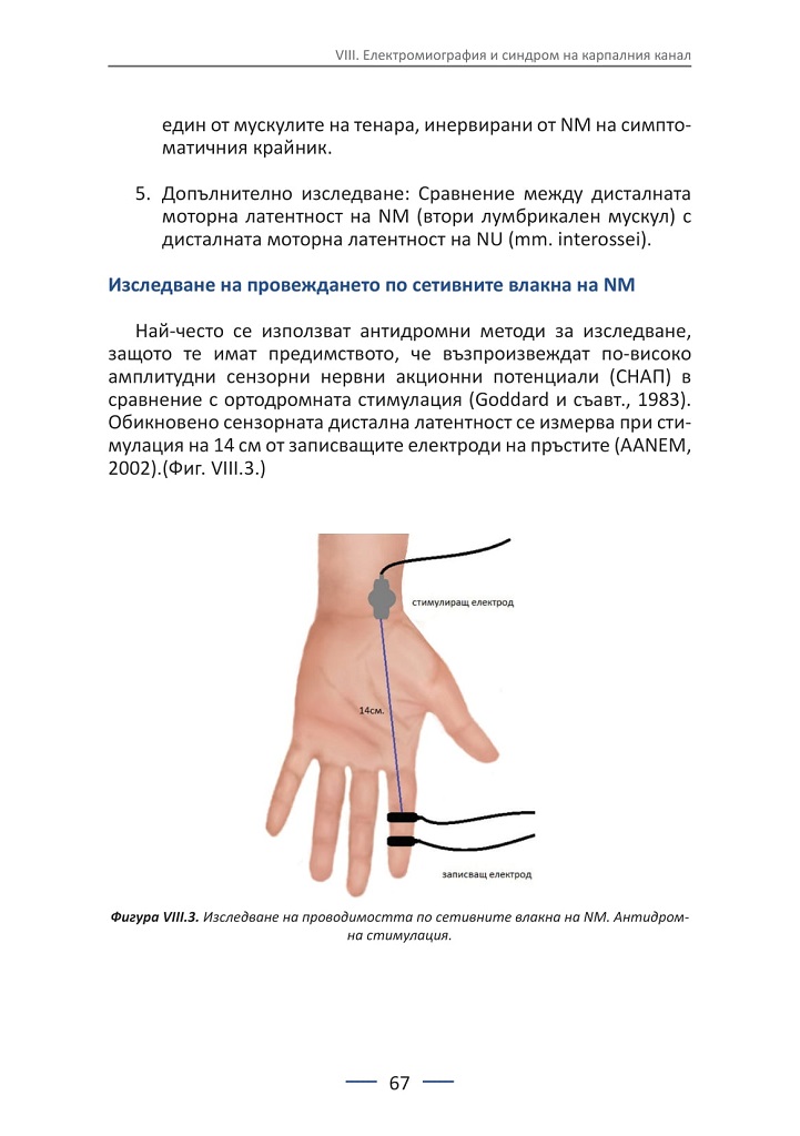 цена на операция на карпалния канал