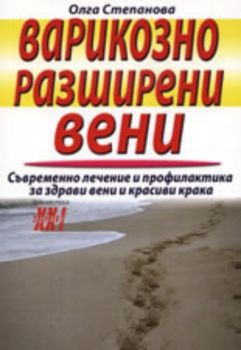 Варикозно разширени вени