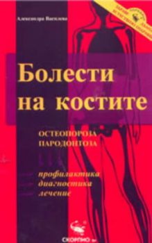 Болести на костите: Остеопороза, пародонтоза